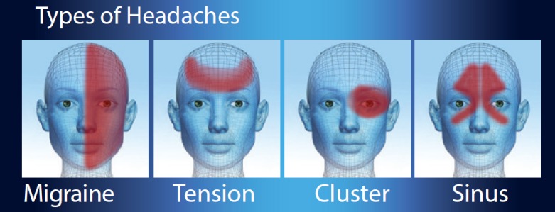 Capture English Types of Headaches 781x299